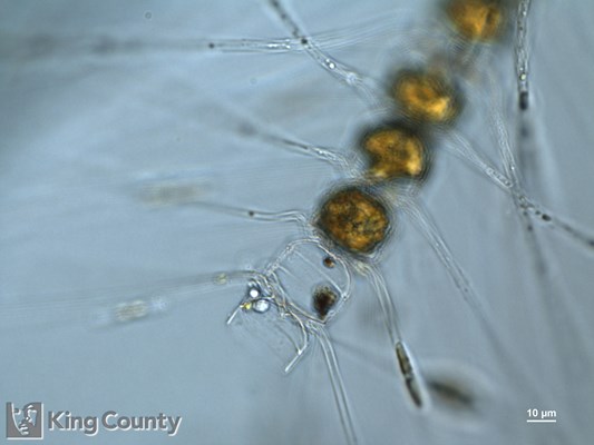 Photo of Chaetoceros convolutus